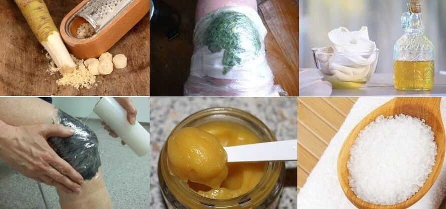 obat tradisional untuk arthrosis sendi lutut